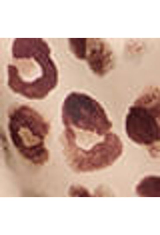 image-a2d7d00019b54927939180f24f8cf11f